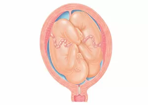 Twin Gallery: Cross section digital illustration of twins in normal position in uterus