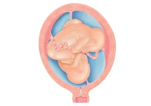 Uterus Prints: Cross section digital illustration of twins showing normal foetal presentation and transverse lie