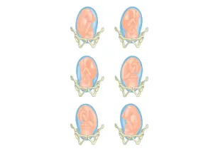 Uterus Prints: Six cross section digital illustrations of foetus showing position head in pelvis