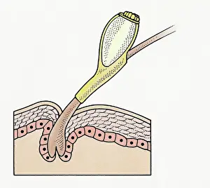 Ugliness Prints: Cross section illustration of Head Louse (Pediculus humanus capitis) egg on human hair