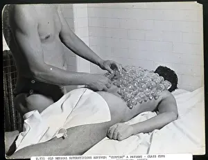 Superstition Prints: Cupping Patient During 1920S Revival