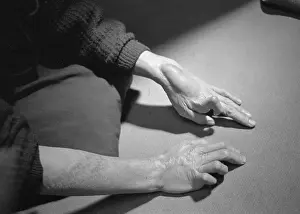Deformed Prints: Deformed Hands Of Hiroshima Woman