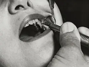 Teeth Prints: Dentist Drilling Inside a Mouth