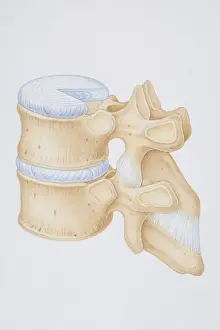 Spinal Cord Prints: Diagram of a human thoracic vertebrae including the intervertebral disk