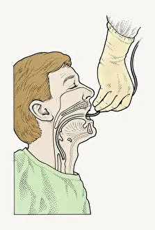 Lying On Back Prints: Diagram showing bronchoscope being inserted into patients throat