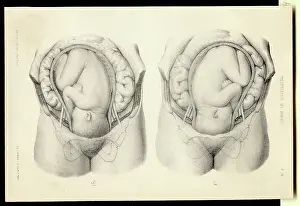 Diagrams of Baby Inside a Woman's Womb