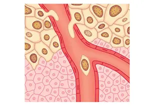 Cancer Prints: Digital illustration of blood vessel wall rupturing