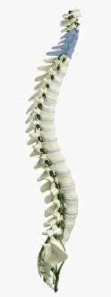 Digital illustration of human spine with damaged area highlighted in blue resulting in quadriplegia