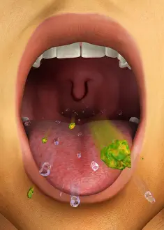 Mouth Open Prints: Digital illustration showing cough reflex action through open mouth