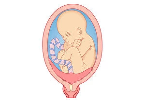 Dorling Kindersley Prints Collection: Digital illustration showing placenta praevia where the placenta is attached to the uterine wall