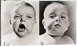 Suspicion Prints: Diptych of Two Babies