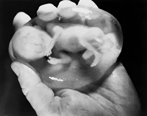Doctor Holding Aborted Fetus