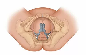 Images Dated 26th February 2015: Doctors view of a baby in occiptital anterior position being delivered by proper use of