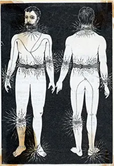 Belt Prints: Electrical Belt Miracle Remedy Of 1870S