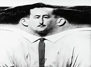 Flattened Periphery of Man's Head