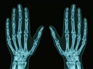 Science Inspired Art Gallery: Hands, X-ray
