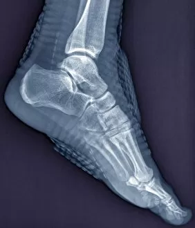 Images Dated 8th September 2018: Healthy ankle joint, X-ray