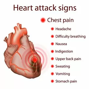 Images Dated 11th November 2018: Heart attack signs, illustration