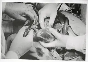 Ann Arbor Prints: A Heart Transplant Operation