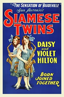 Twins Prints: Hilton Sisters - Siamese Twins