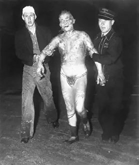 Injury Prints: Hindenberg Victim Rushed to First Aid