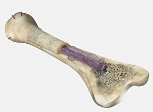 Human bone, cross section diagram of Femur showing osteon, veins, marrow