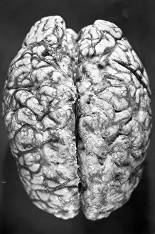 Body Part Prints: Top of Human Brain