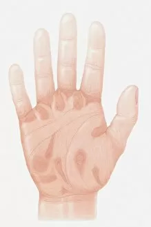 Illustration of accu-pressure points on palm of human hand