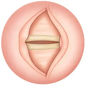 Singer Prints: Illustration of closed human vocal fold also known as vocal cord