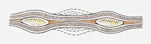 Esophagus Prints: Illustration of contractions of muscles in the wall of the oesophagus (peristalsis)