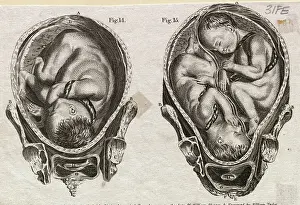 Illustration Depicting Fetuses in the Womb