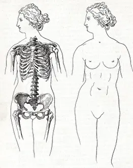 Illustration of Two Female Anatomies Not Influenced by Use of Corsets