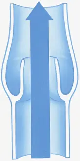 Valve Prints: Illustration of open valve with arrow showing direction of blood flow