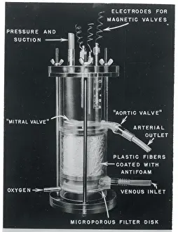 Nashville Prints: Illustration of Oxygen Pump