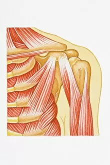 Images Dated 23rd April 2008: Illustration of separated shoulder, also known as a sprain, with circle around glenohumeral ligament