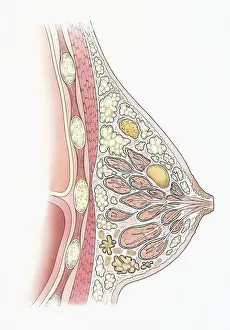 Illness Prints: Illustration showing cyst, fibroadenoma