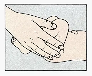 Lying On Back Prints: Illustration showing physical examination of babys legs to check alignment immediately after birth