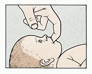 Lying On Back Prints: Illustration showing physical examination of babys mouth and palate immediately after birth