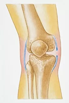 Images Dated 23rd April 2008: Illustration showing torn human knee ligament