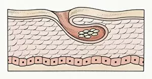 Animal Behaviour Gallery: Illustration of subcutaneous scabies eggs