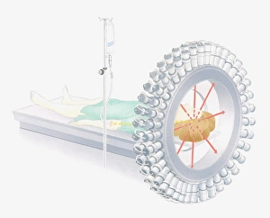 Images Dated 11th March 2010: Illustration of using radioactive isotopes (radionuclides) for medical imaging