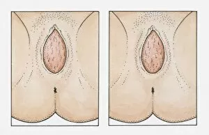 Images Dated 25th March 2010: Two illustrations of babys head appearing from a pregnant womans vagina