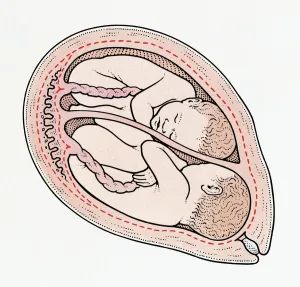 Uterus Prints: Illuystration of twin foetuses in normal position in cross section of human uterus