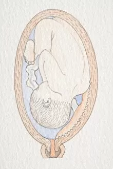 Images Dated 30th June 2006: Inverted foetus inside swollen uterus with placenta close to the cervix opening