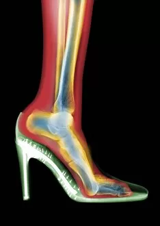 Biological Gallery: Leg in stiletto shoe MRI style, X-ray