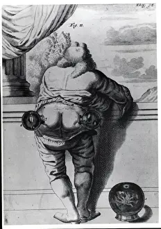 Tube Prints: Man With Glass Tubes On Posterior;Engrav