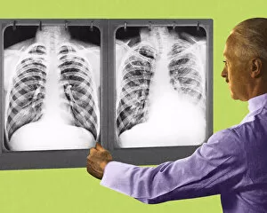 Images Dated 10th July 2014: Man Looking at Two Chest X-Rays