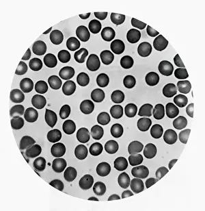 Microscopic Prints: Microscopic View of Red Blood Cells