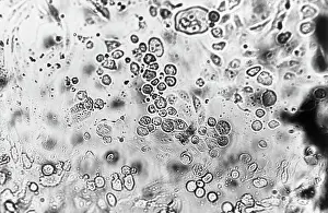 Virus Prints: Microscopic View Of Virus-Infected Cell