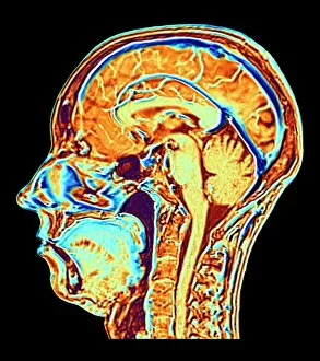 Images Dated 11th November 2018: MRI scan of normal brain, illustration